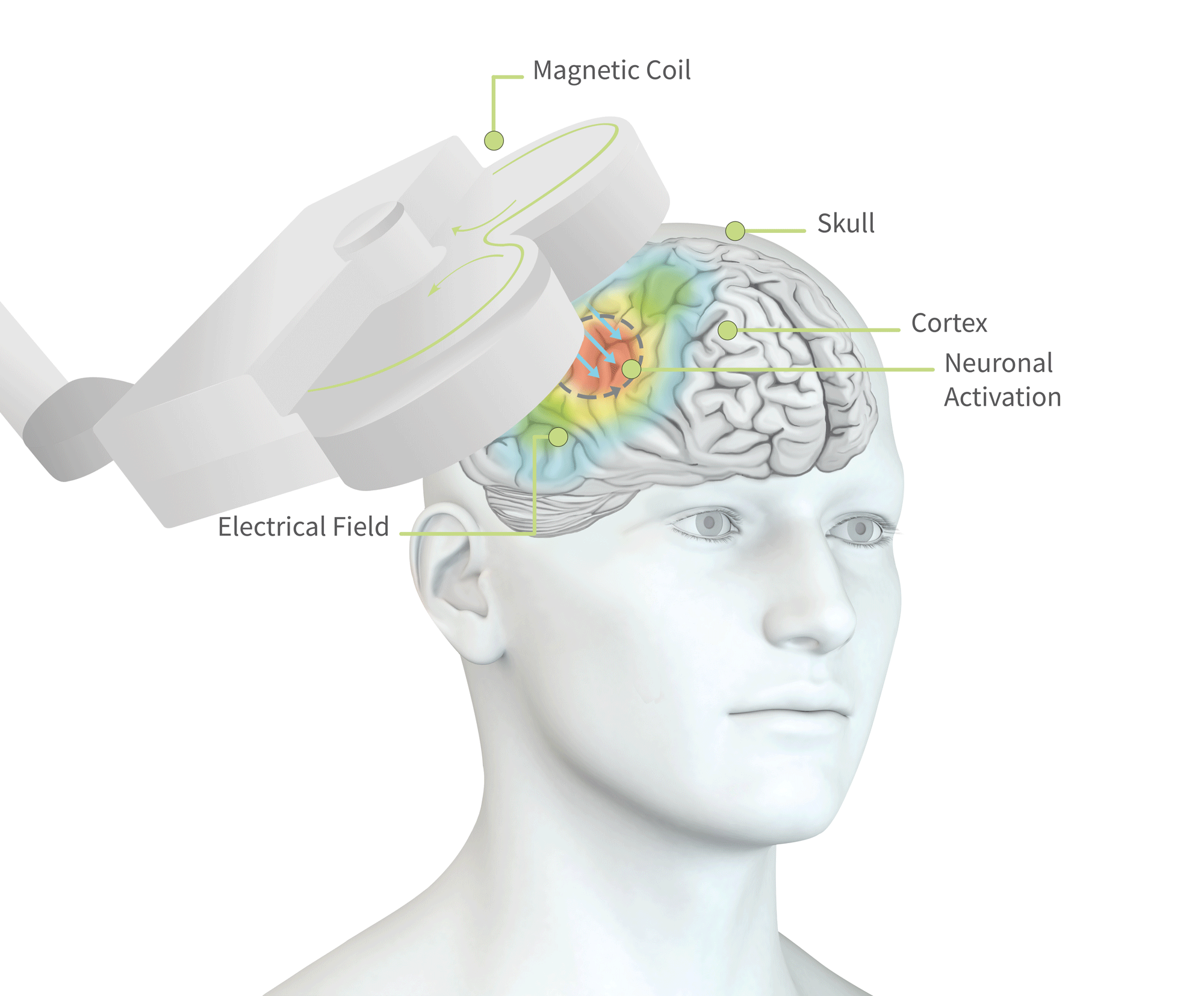 Diagram showing how TMS magnetic coil stimulates the brain